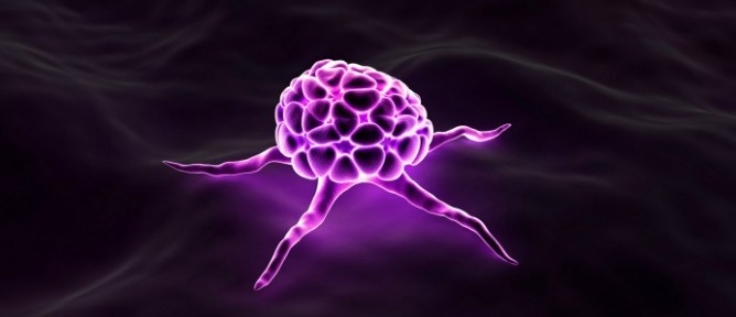Israeli scientists hope to be able to render cancer cells like this one incapable of reproducing. Image via Shutterstock.com