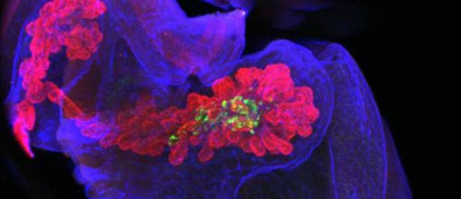 Insulin is made in the islet cells of the pancreas (highlighted). Image courtesy of Yuval Dor/Hebrew University-Hadassah Medical School.