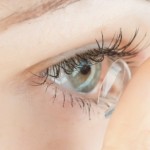 A revolutionary disposable lens to treat corneal edema. Image via Shutterstock
