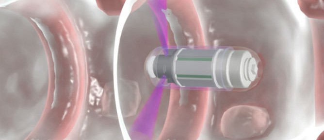 The Check-Cap capsule as it looks passing through the colon.